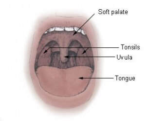 soft palate2