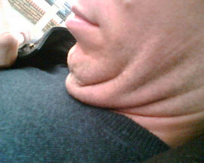 fatneck