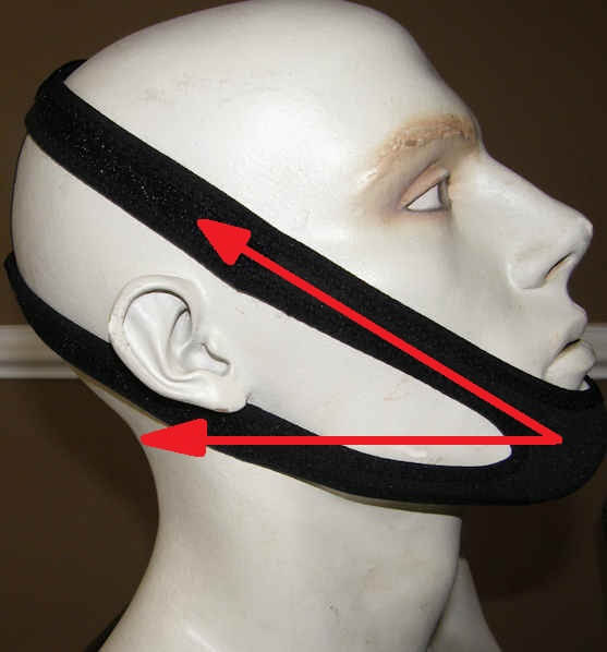 snoring chin strap