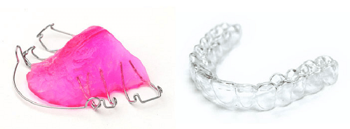 Typical retainers. Note the metal framework of the one on the left and custom shape of the one on the right