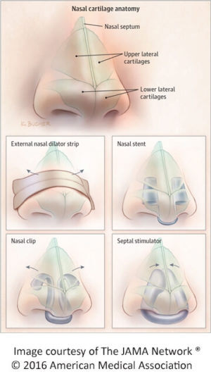 Illustration showing anatomy of the nost